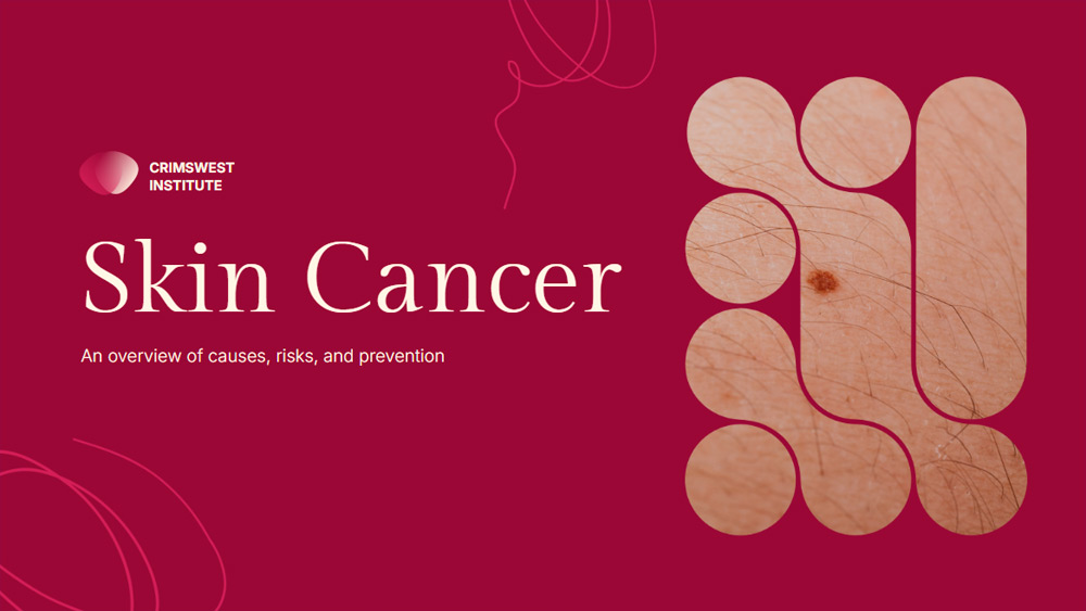 Skin Tumor